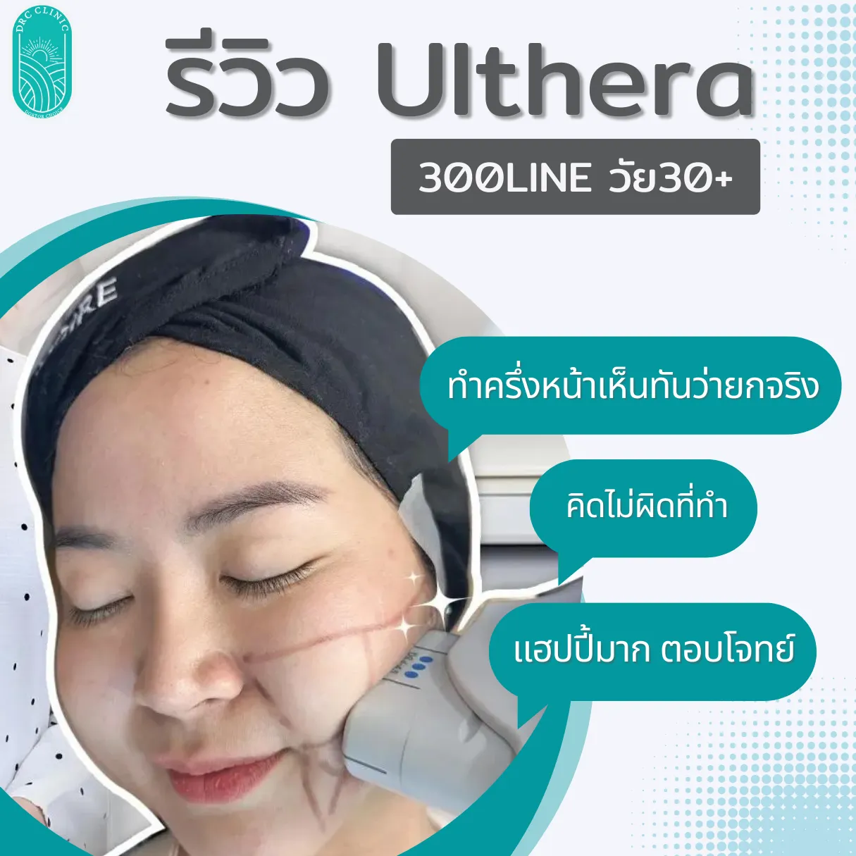 Review Ulthera Age30+ 300LINE