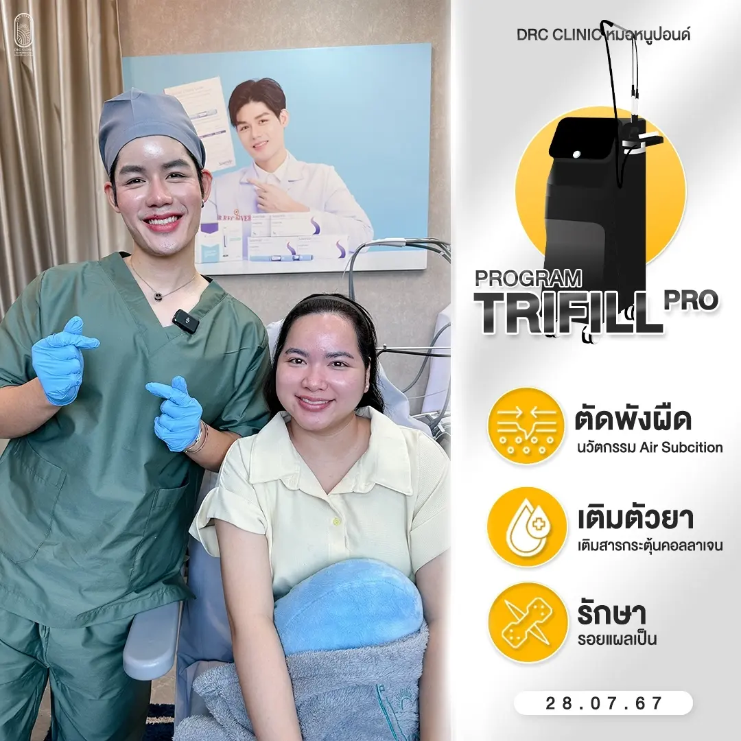 Trifill Pro Air Subcision ตัดพังผืดหลุมสิวที่ DRC Clinic 005